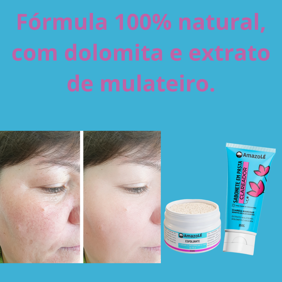 Clareador de Manchas de Pele Amazolé