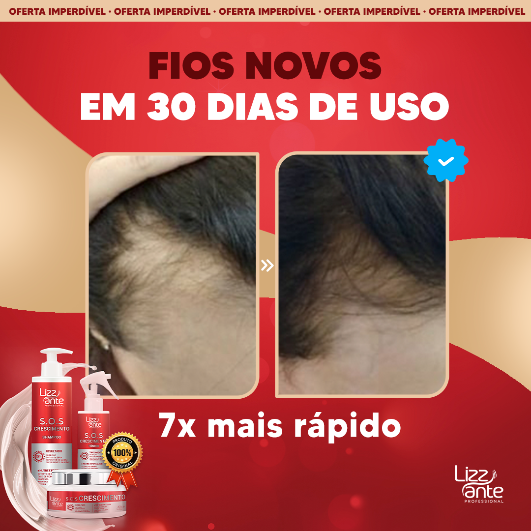 Poderoso Tratamento Capilar KIT SOS Crescimento da LIZZ ANTE Profissional