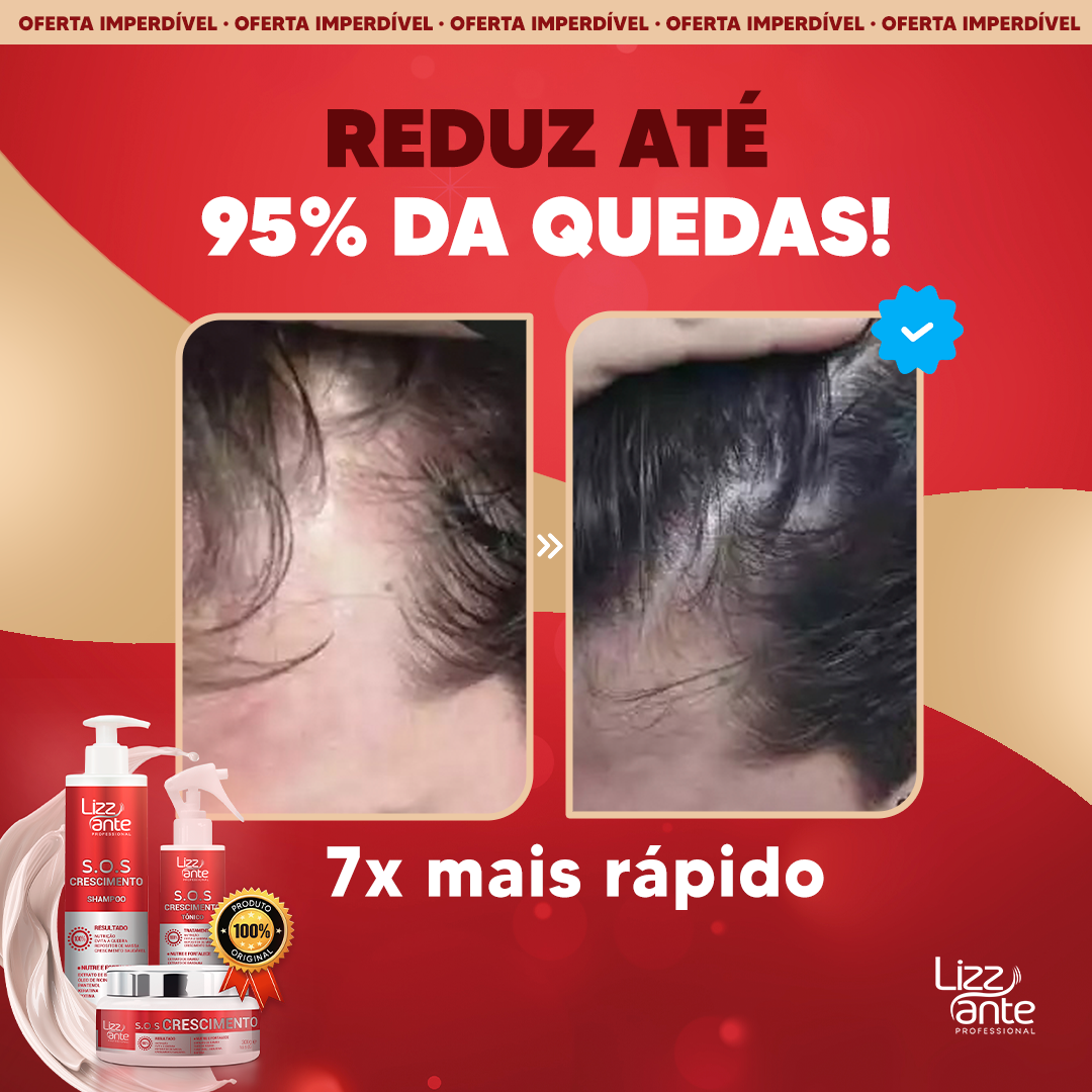 Poderoso Tratamento Capilar KIT SOS Crescimento da LIZZ ANTE Profissional