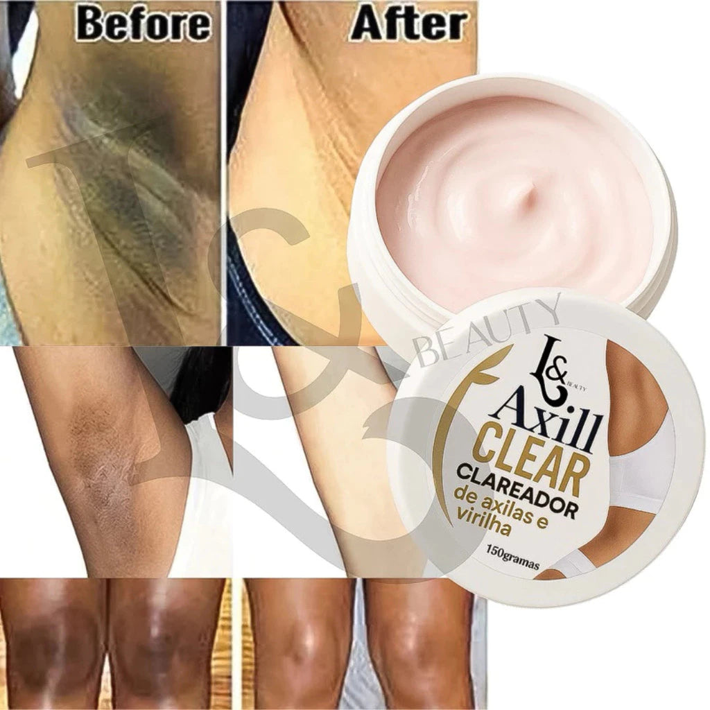 Clareador Axilas & Virilha e Redutor de Estrias L&Beauty ( Compre 1 Leve 2 )