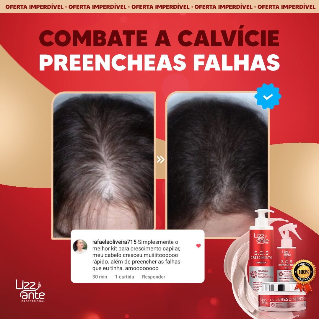 Poderoso Tratamento Capilar KIT SOS Crescimento da LIZZ ANTE Profissional